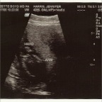 BabyHarris11172006-2