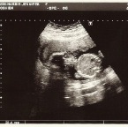 BabyHarris12192006-2