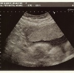 BabyHarris 2.21.2007-1