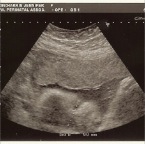 BabyHarris 2.21.2007-2