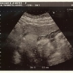 Baby Harris 3.21.2007